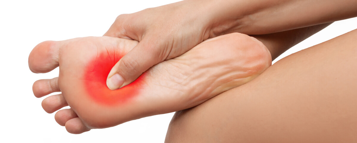Fascite plantar
